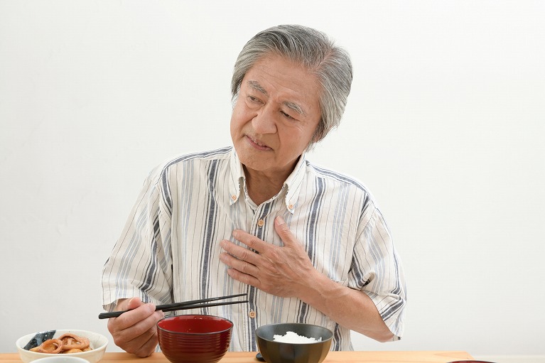 逆流性食道炎とは